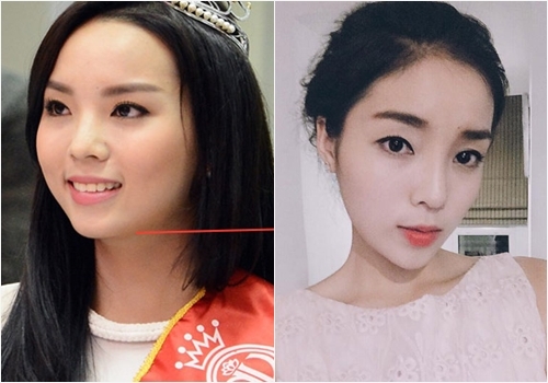Kỳ Duyên vướng “nghi án” phẫu thuật thẩm mỹ
