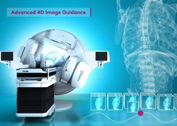 Những tiến bộ trong điều trị ung thư phổi bằng tia phóng xạ