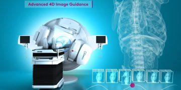 Những tiến bộ trong điều trị ung thư phổi bằng tia phóng xạ