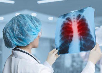 WHO: Bệnh lao trở lại là nguyên nhân gây tử vong hàng đầu do bệnh truyền nhiễm