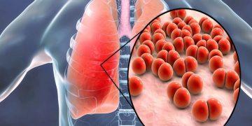 Bệnh viện Phổi Trung ương tổ chức Hội thảo khoa học “Ngày nấm toàn cầu 2025” lần thứ 6